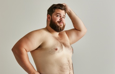 Gynecomastia