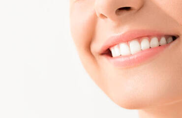 Das Hollywood Smile: Eine detaillierte Schritt-für-Schritt-Anleitung