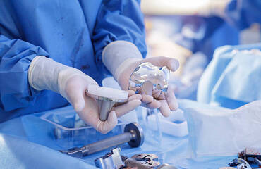 Implants du genou : un guide simple