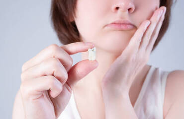 Tout ce que vous devez savoir sur les dents de sagesse