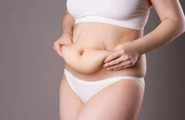 Vous luttez contre un excès de peau après une perte de poids ? Voici comment une abdominoplastie peut vous aider