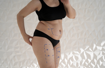 Ozon tedavisi nedir? Ozon tedavisi kimlere uygulanır?