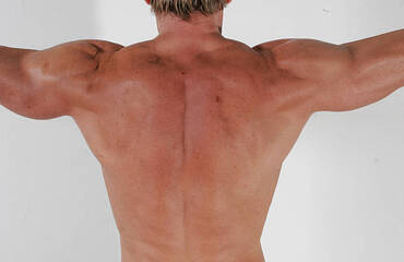 Back Lift Surgery: Restore Confidence, Redefine Your Silhouette