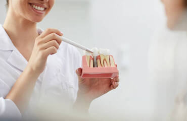Dental Implant Healing Stages: What to Expect Week by Week