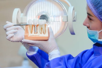 A Simple Guide to Dental Implants 