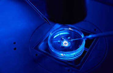 Step-by-Step: The IVF Process Explained